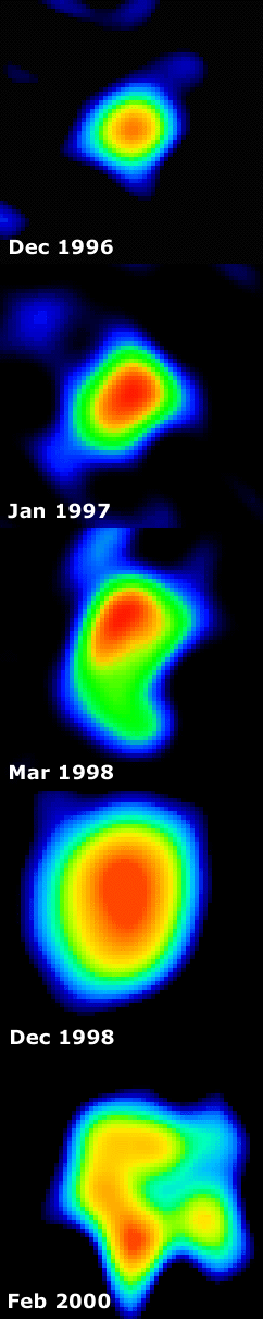 The remnant
of V723 Cas in the radio
